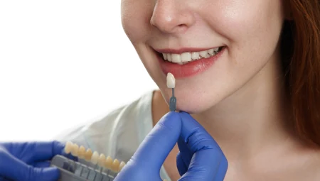 Ultra-Thin Porcelain Veneers