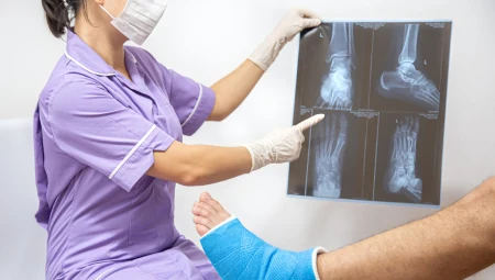 Splinting & Cast Immobilization for Fractures