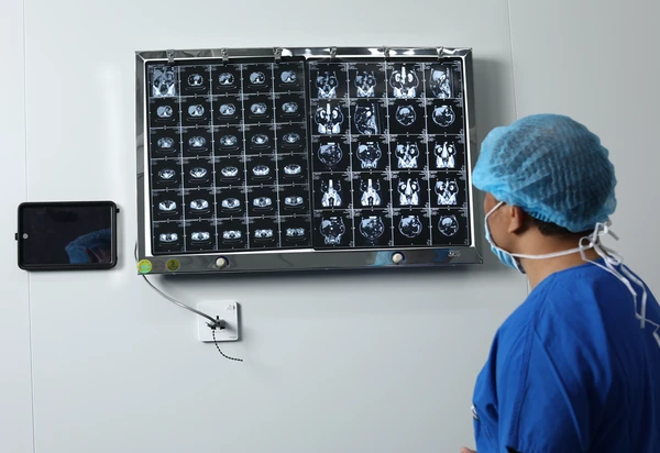 Bác sĩ chuyên khoa Bệnh Viện Sante đánh giá chi tiết phim chụp và hội chẩn phác đồ tối ưu cùng ekip