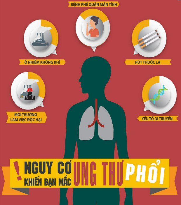 Nguyên nhân ung thư phổi, yếu tố ảnh hưởng, cách phòng ngừa