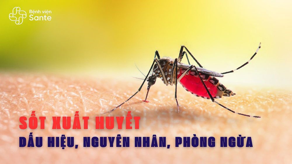 Bệnh sốt xuất huyết