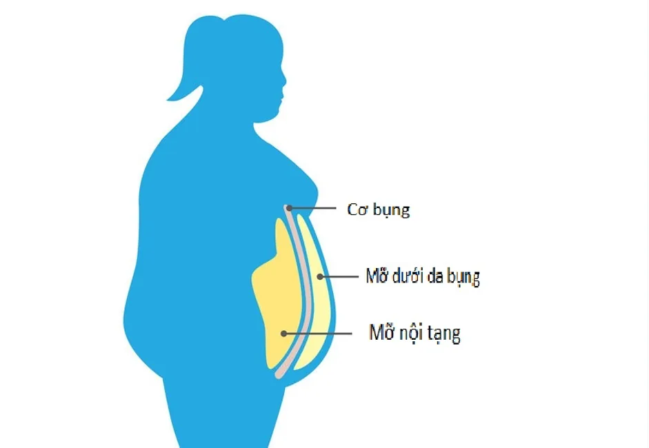 CAUSES OF VISCERAL FAT - Image 3 - SANTE Hospital, Binh Thanh, HCMC