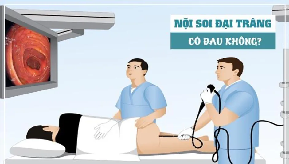 대장암 정밀 선별검사 방법 - 이미지 3 - 산테 병원, 호치민시 빈탄